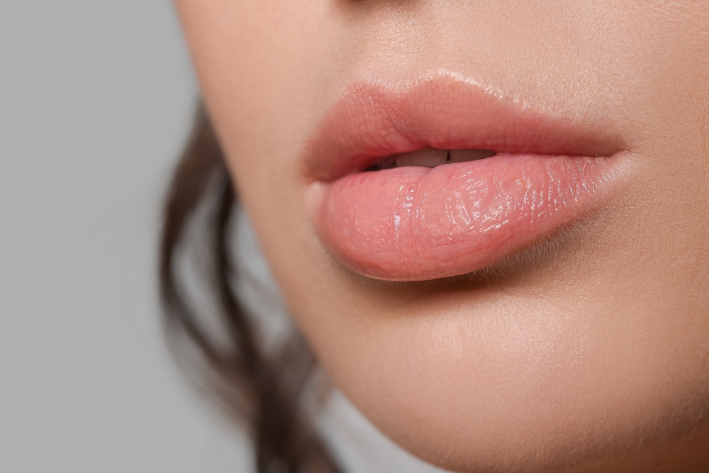 How Long Does It Take for Lip Fillers to Settle?