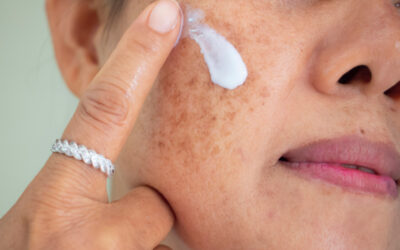 How to repair sun damaged skin