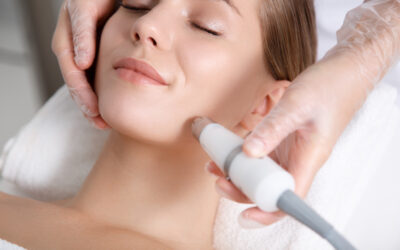 Melasma Laser Treatment: Options, Effectiveness, and What to Expect